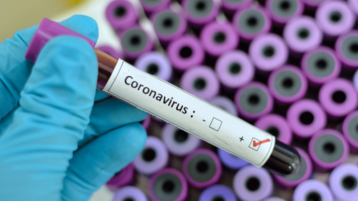 Coronavirus test