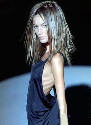 Anorexic model